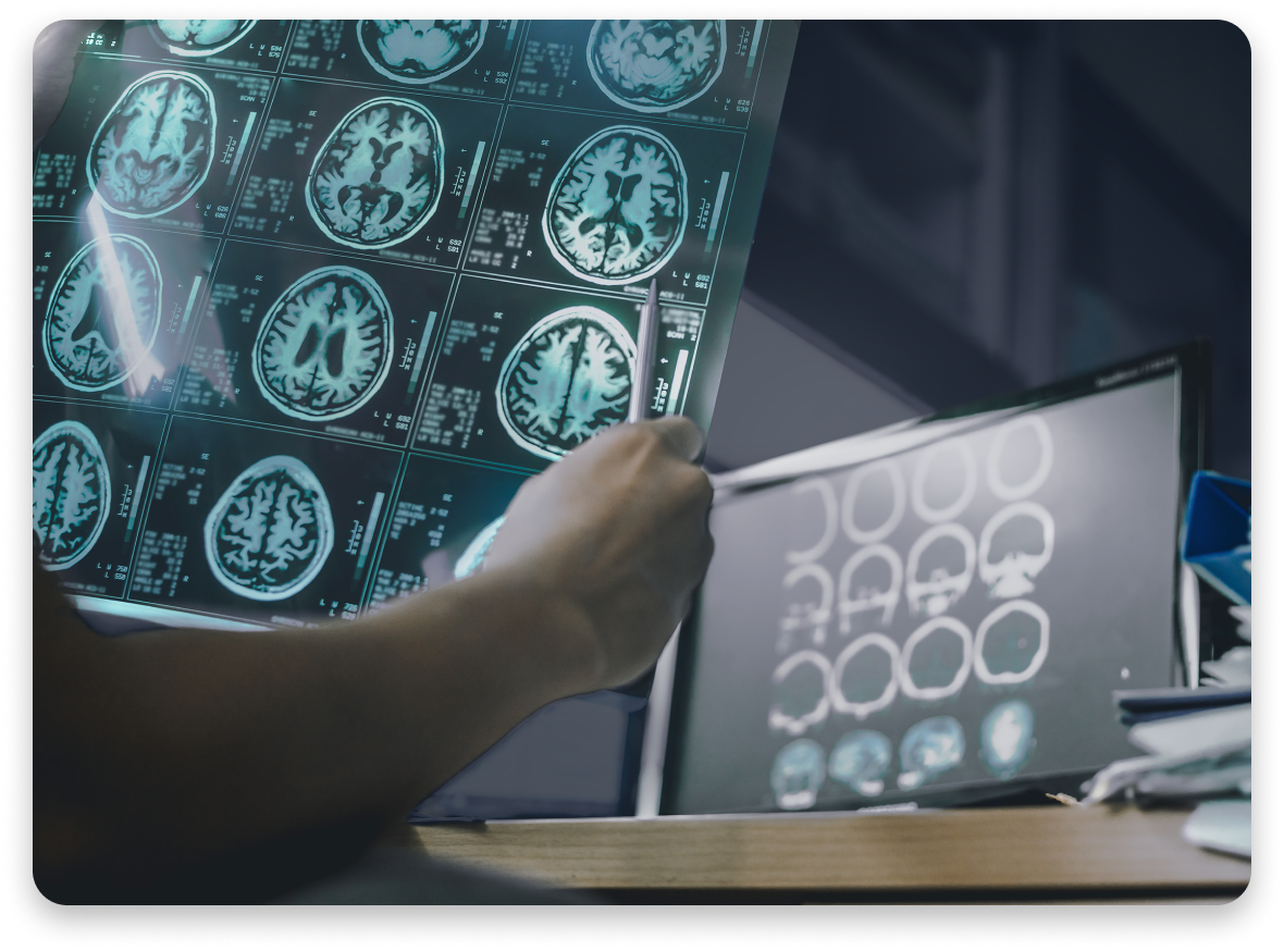 Medical professional reviewing brain scans on digital devices
