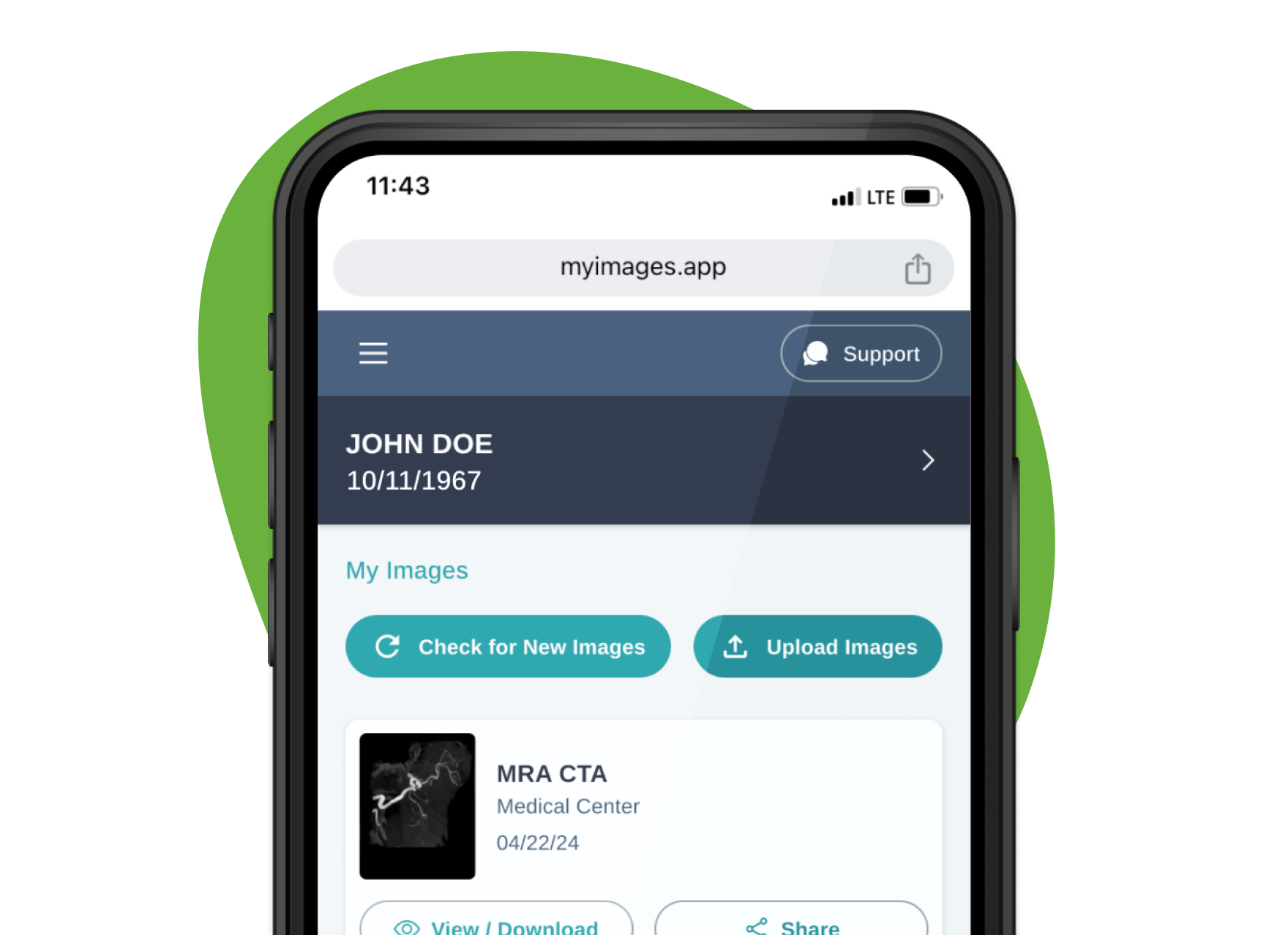 DICOM viewer interface showing medical imaging studies and patient records