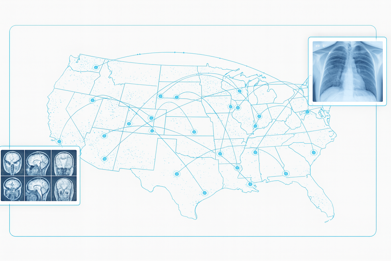 Nexus-MD nationwide network visualization showing connected imaging centers across the United States with medical scan examples